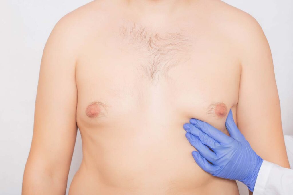 puffy nipples male