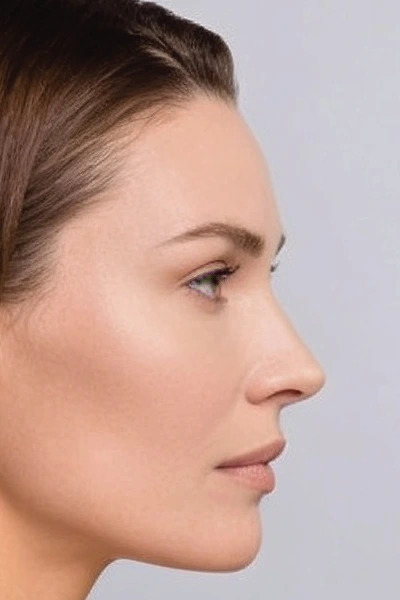 rhinoplasty-surgery-manchester